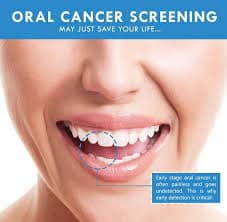 Oral Cancer Screenings Save Lives - Eagle Rock Dental Care